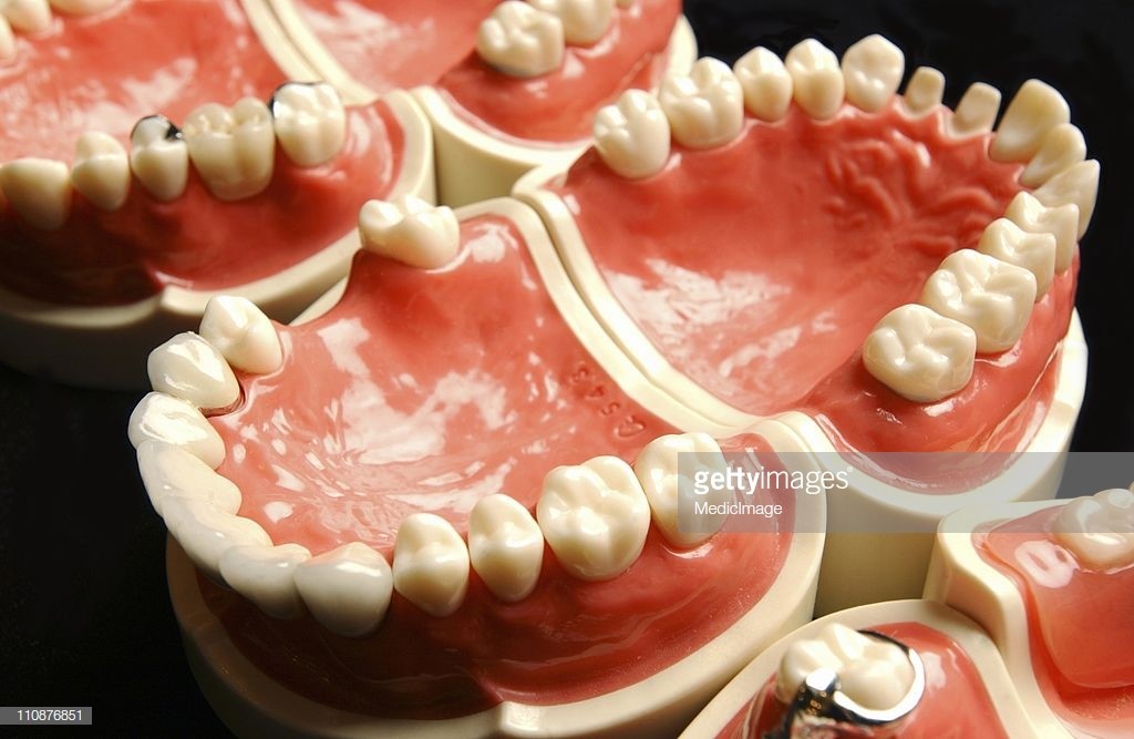 How To Clean Partial Dentures Tacoma WA 98477